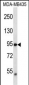 TRPV2 Antibody (N-term)