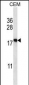 EIF5A2 Antibody (C-term)