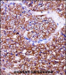 BAG2 Antibody (C-term)