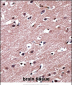 RORB Antibody (C-term)