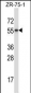 RORB Antibody (C-term)