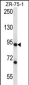 CSTF3 Antibody (C-term)