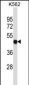 P2RX5 Antibody (C-term)