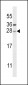 TICAM2 Antibody (N-term)