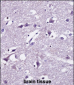 SEC22B Antibody (Center)