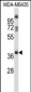 GPR15 Antibody (C-term)