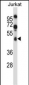 SPN/CD43 Antibody (Center)