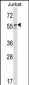 BECN1 Antibody (N-term T72)