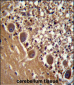 FARSB Antibody (C-term)