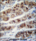 PCIA1 Antibody (Center)
