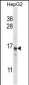 PCIA1 Antibody (Center)