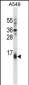 BBC3 Antibody (Center)