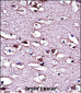 LMO2 Antibody (N-term)