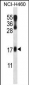 LMO2 Antibody (N-term)