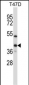 ERCC1 Antibody (C-term)