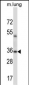 ERCC1 Antibody (C-term)