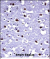 TARBP2 Antibody (N-term)