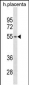 TARBP2 Antibody (N-term)