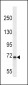 KLKB1 Antibody (C-term)