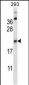 AES Antibody (C-term)