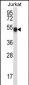 PNKP Antibody (N-term)
