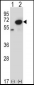 PNKP Antibody (N-term)
