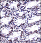 CFL2 Antibody (N-term)