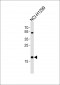 CFL2 Antibody (N-term)