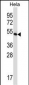 EEF1G Antibody (Center)