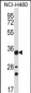 AKR1B10 Antibody (Center)