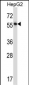 NFIA Antibody (C-term)