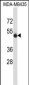 SPN/CD43 Antibody (N-term)