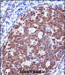 ZAP70 Antibody (Center)