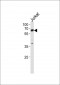 ZAP70 Antibody (Center)