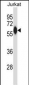 ZAP70 Antibody (N-term)