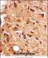 Mouse Pxk Antibody (Center)