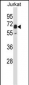 Mouse Pxk Antibody (Center)