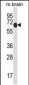 Mouse Pxk Antibody (Center)