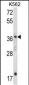 JMJD6 Antibody (C-term)