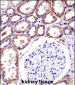 RC3H1 Antibody (C-term)