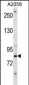 CRTC2 Antibody (C-term)