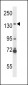 NOS2A Antibody (N-term)