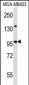 NUP88 Antibody (C-term)