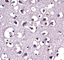 LPL Antibody (Center)