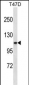 COL3A1 Antibody (C-term)