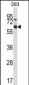 MEF2D Antibody (Center)