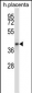 GNAQ Antibody (N-term)