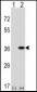 GNAQ Antibody (N-term)