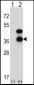 CD72 Antibody (Center)