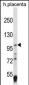 EPAS1 Antibody (C-term)